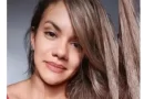 Juliana Soares é internada para primeira cirurgia de reconstrução facial