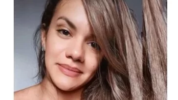 Juliana Soares é internada para primeira cirurgia de reconstrução facial Juliana Soares é internada para primeira cirurgia de reconstrução facial