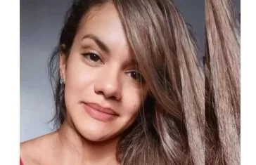 Juliana Soares é internada para primeira cirurgia de reconstrução facial
